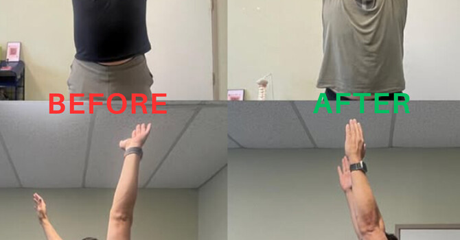 Shoulder Pain With Lifting in Las Cruces: Why Avoiding Exercise Is Not Always the Answer